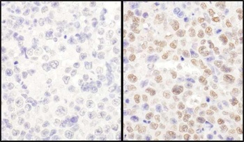 Rabbit anti-LAS1L Antibody