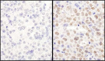 LAS1L Antibody