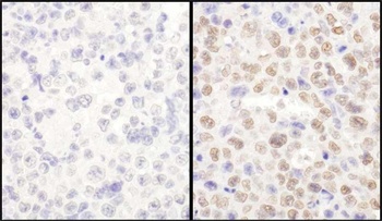 LAS1L Antibody