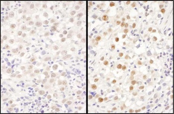 LAS1L Antibody