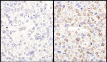 Rabbit anti-LAS1L Antibody