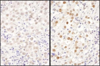 Rabbit anti-LAS1L Antibody