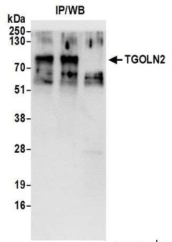 Rabbit anti-TGOLN2 Antibody
