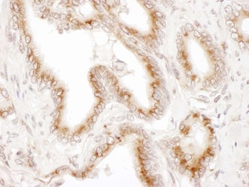 Rabbit anti-TGOLN2 Antibody