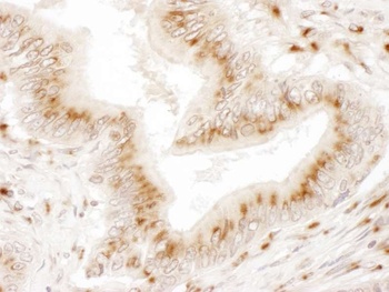 Rabbit anti-TGOLN2 Antibody