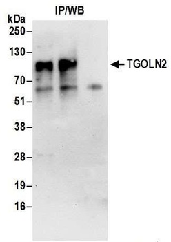 Rabbit anti-TGOLN2 Antibody
