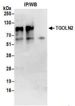 TGOLN2 Antibody