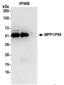 MPP1/P55 Antibody