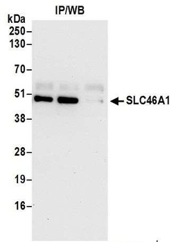 Rabbit anti-SLC46A1 Antibody