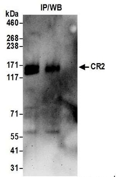 Rabbit CR2 Antibody