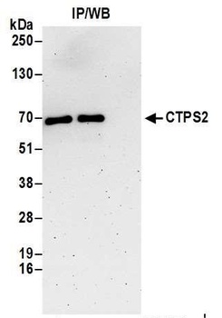 CTPS2 Antibody