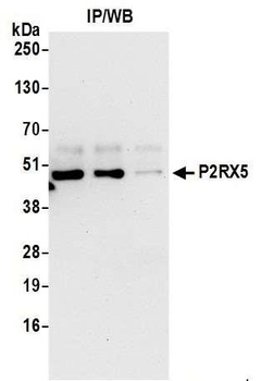 P2RX5 Antibody