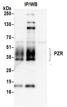 PZR Antibody