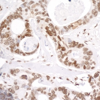 Rabbit anti-RNA Polymerase II, Phospho (S5) Antibody