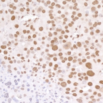 Rabbit anti-RNA Polymerase II, Phospho (S5) Antibody