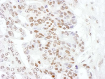 Rabbit anti-RNA Polymerase II, Phospho (S2) Antibody