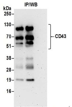 Rabbit CD43 Antibody