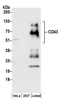 Rabbit CD43 Antibody