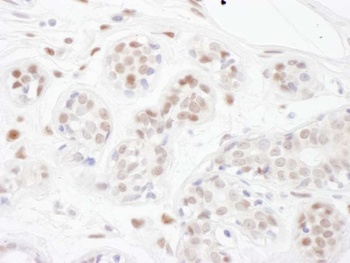 Rabbit anti-PINX1 Antibody