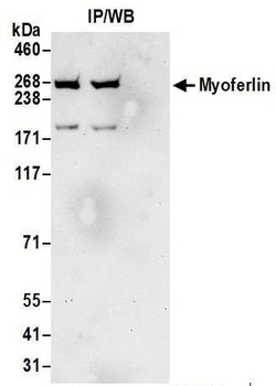 Myoferlin Antibody
