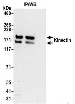 Rabbit Kinectin Antibody