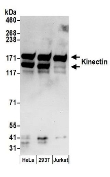Rabbit Kinectin Antibody