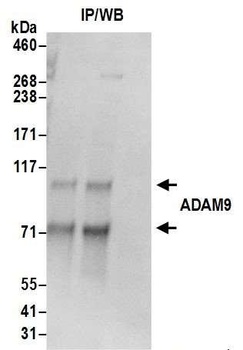 Rabbit ADAM9 Antibody