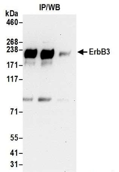 ErbB3 Antibody