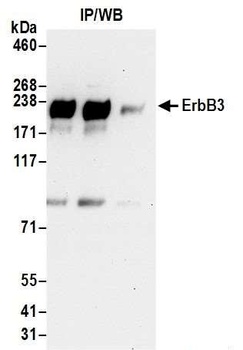Rabbit ErbB3 Antibody