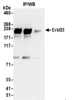 Rabbit ErbB3 Antibody