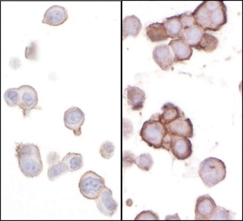 Rabbit B7-H3/CD276 Antibody