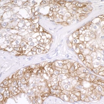 Rabbit B7-H3/CD276 Antibody