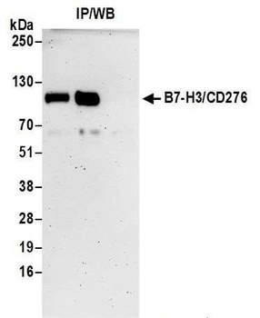 Rabbit B7-H3/CD276 Antibody