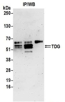 TDG Antibody