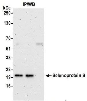 Selenoprotein S Antibody