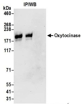 Rabbit Oxytocinase Antibody