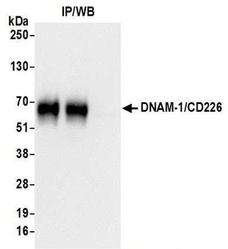 DNAM-1/CD226 Antibody