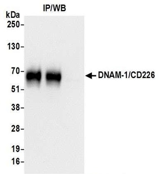 Rabbit DNAM-1/CD226 Antibody