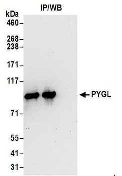 PYGL Antibody