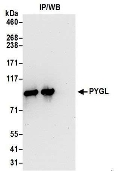 Rabbit anti-PYGL Antibody