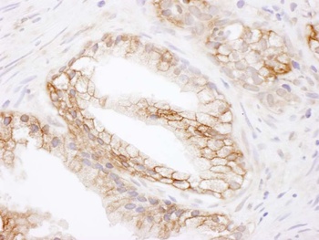 Rabbit MCT1 Antibody