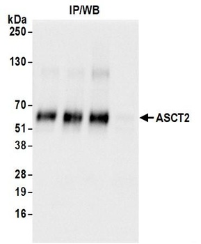 ASCT2 Antibody