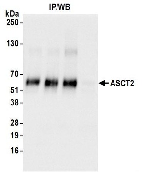 Rabbit anti-ASCT2 Antibody
