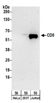 Rabbit CD5 Antibody