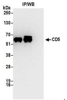 Rabbit CD5 Antibody