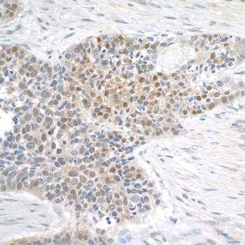 Rabbit anti-MGEA5 Antibody