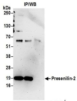 Rabbit anti-Presenilin-2 Antibody