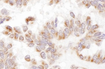 Rabbit anti-Presenilin-2 Antibody