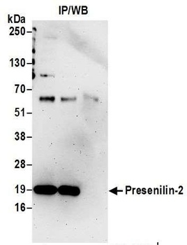 Presenilin-2 Antibody