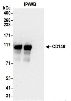 Rabbit CD146 Antibody